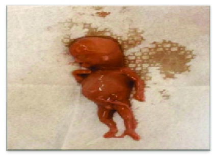 L-albatross m’għonq il-Partit Laburista fil-Gvern